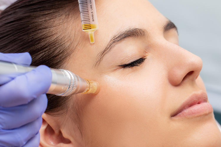 Skin Booster Treatment