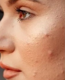 Before Treatment